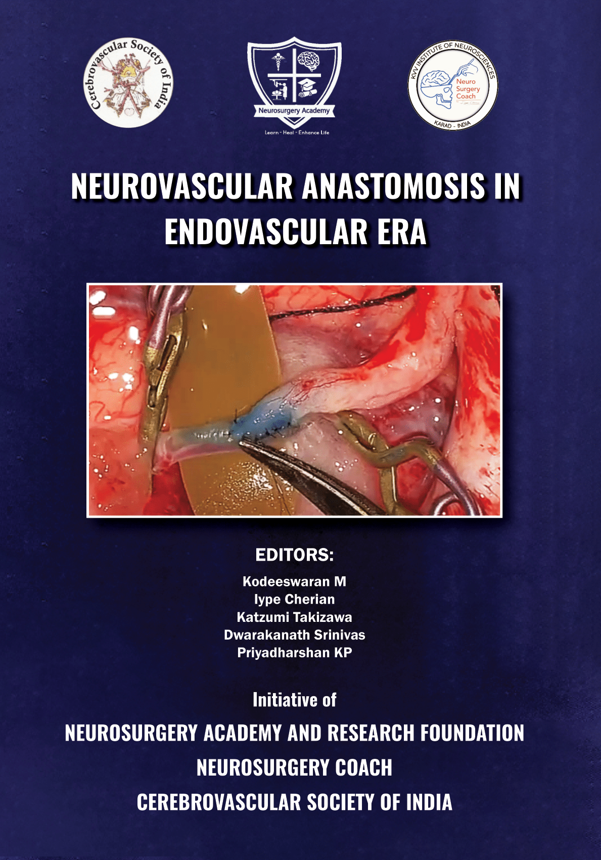 Neurovascular Anastomosis in Endovascular Era